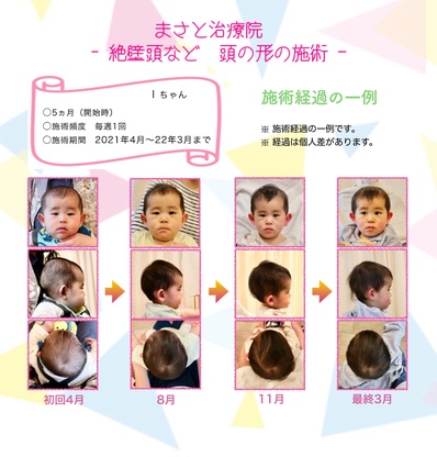 斜頭