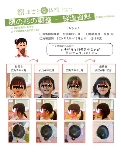 絶壁を治す