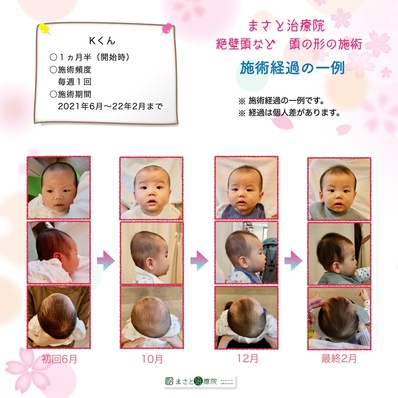 斜頭