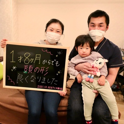 頭の形の改善