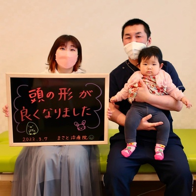 斜頭症　治す