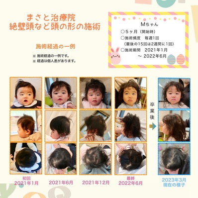 斜頭