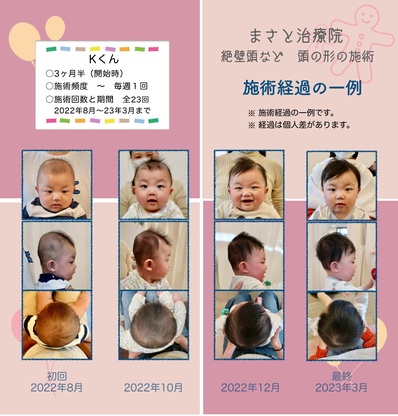 絶壁頭