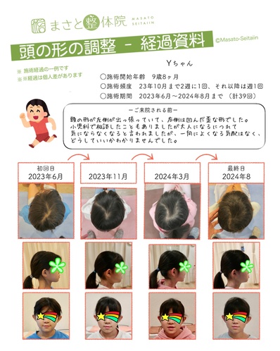 小学生の絶壁