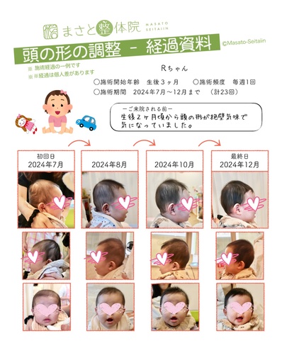 絶壁を治す