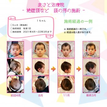 斜頭