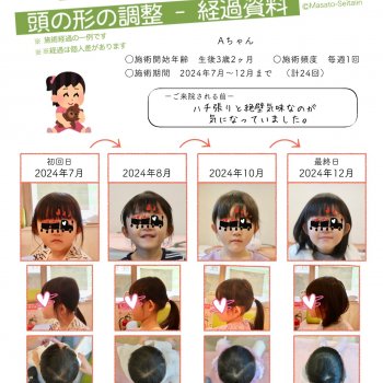 絶壁を治す