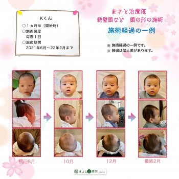 斜頭