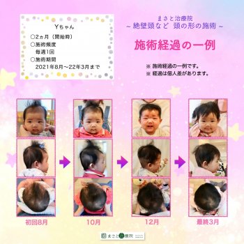 絶壁