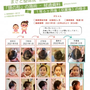頭の形を治す