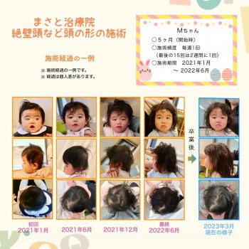 斜頭