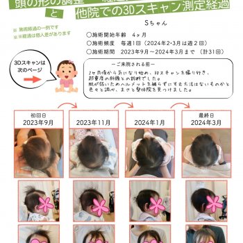 斜頭を治す