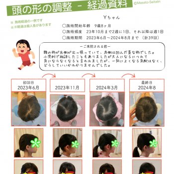 小学生の絶壁