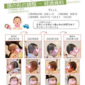 絶壁を治す