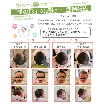 絶壁治療