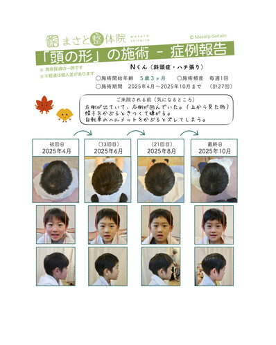 ハチ張りを治す