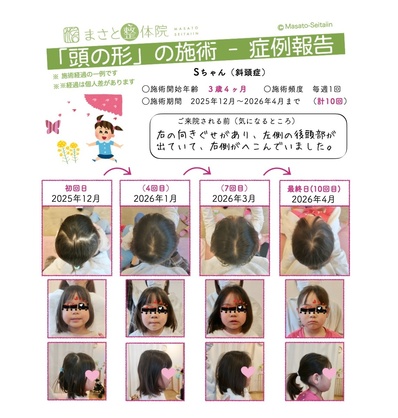 ヘルメット治療