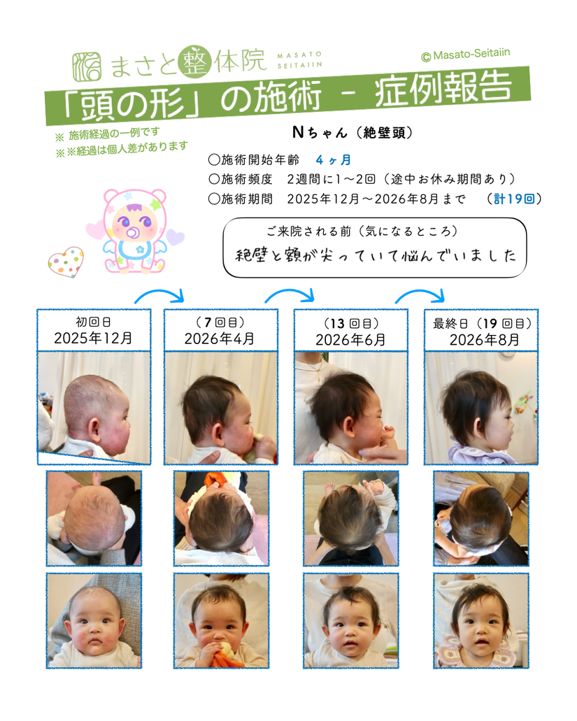 絶壁頭