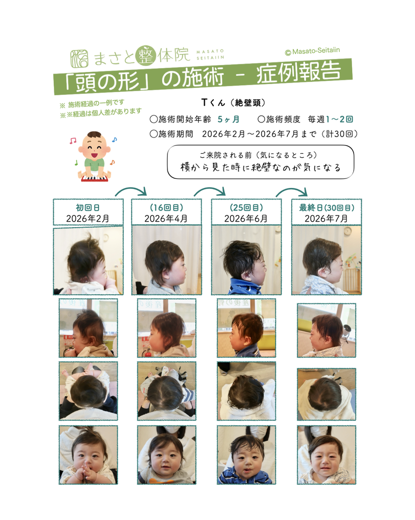 絶壁を治す
