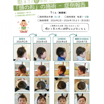 絶壁を治す