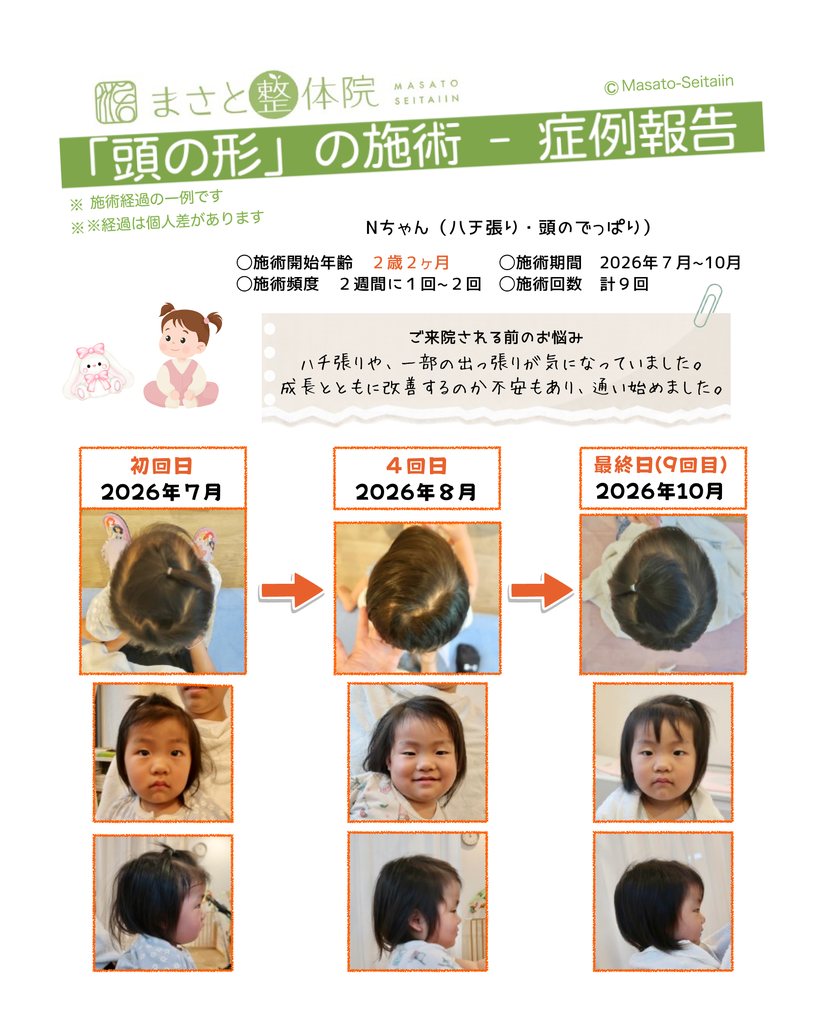頭の形