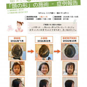 頭の形