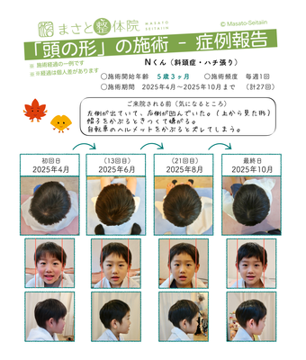 ハチ張りを治す