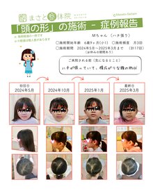 子どものハチ張り