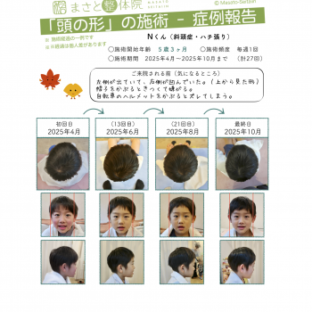 ハチ張りを治す